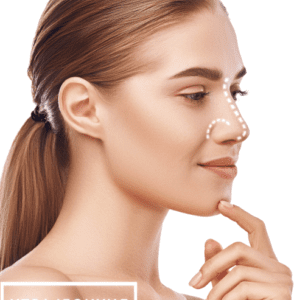 Non-surgical nose job treatment improving nose shape and facial symmetry without surgery